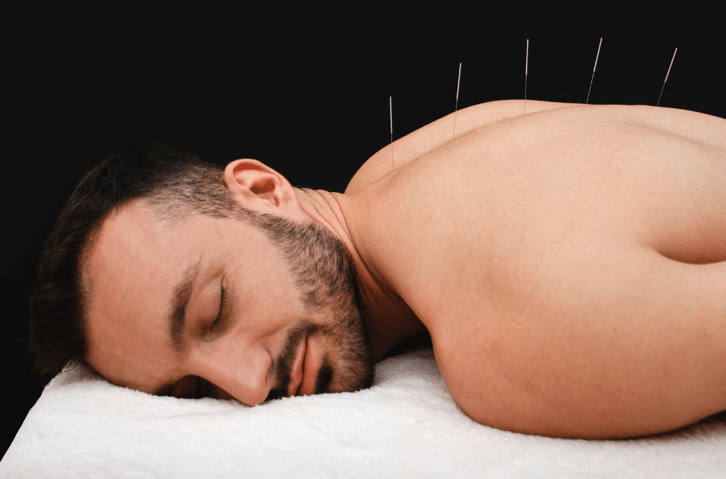 Acupuncture: Ancient Healing Art for Holistic Well-Being