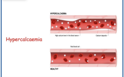 Proposed subclinical calcium dysregulation syndrome (scds): mechanisms, predispositions, clinical implications, and therapeutic strategies.