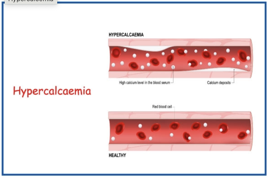 Proposed subclinical calcium dysregulation syndrome (scds): mechanisms, predispositions, clinical implications, and therapeutic strategies.